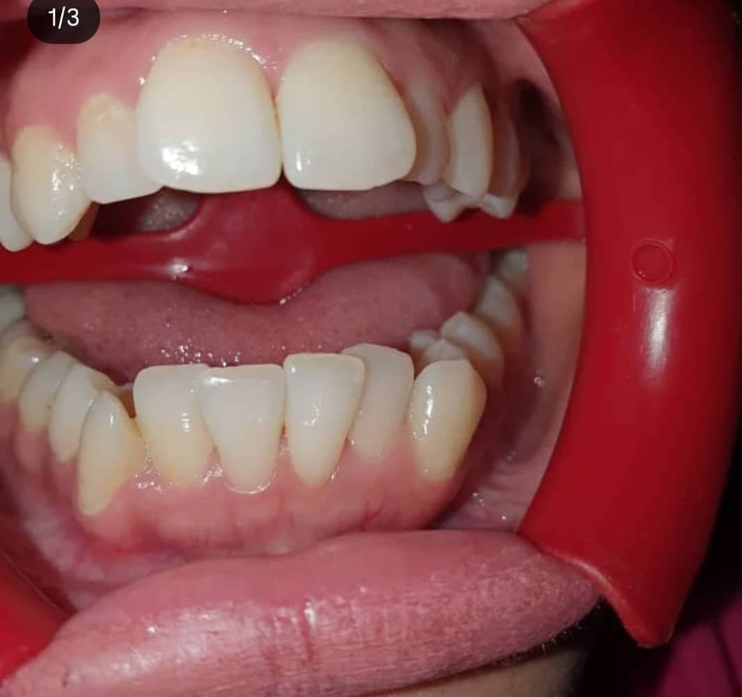 لابراتوار پروتزهای دندانی آرمان سلامت در بوکان