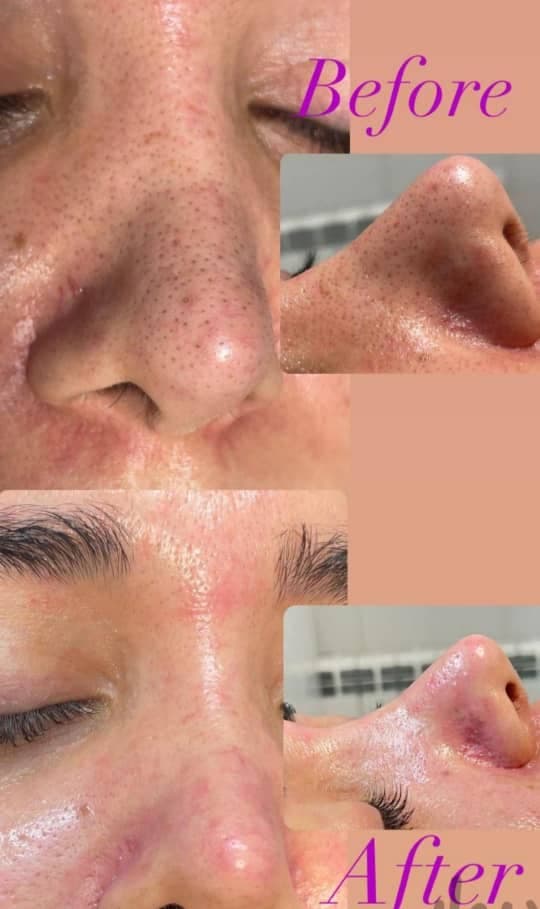 آموزش فشیال و پاکسازی پوست مریم فیروزی در قائمشهر