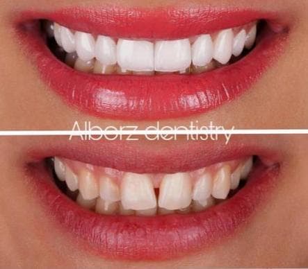 کلینیک دندانپزشکی دکتر فتوی در 45 متری گلشهر کرج