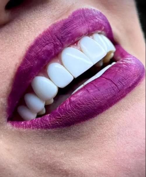 کلینیک دندانپزشکی دکتر فتوی در 45 متری گلشهر کرج