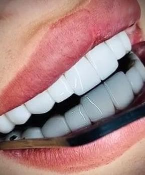 کلینیک دندانپزشکی دکتر فتوی در 45 متری گلشهر کرج