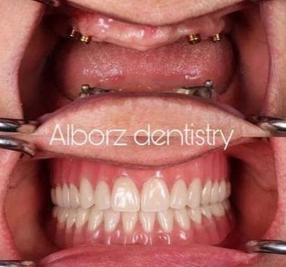 کلینیک دندانپزشکی دکتر فتوی در 45 متری گلشهر کرج