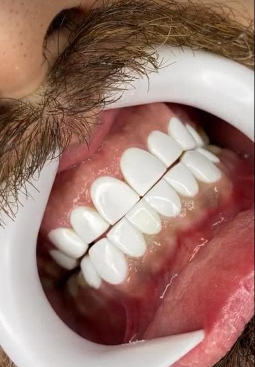 کلینیک دندانپزشکی دکتر فتوی در 45 متری گلشهر کرج