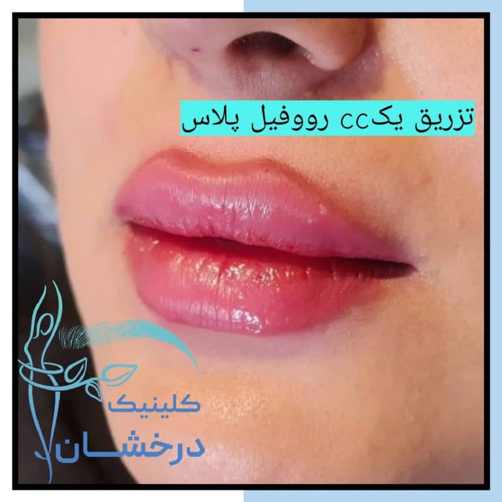 کلینیک زیبایی درخشان در کرمانشاه