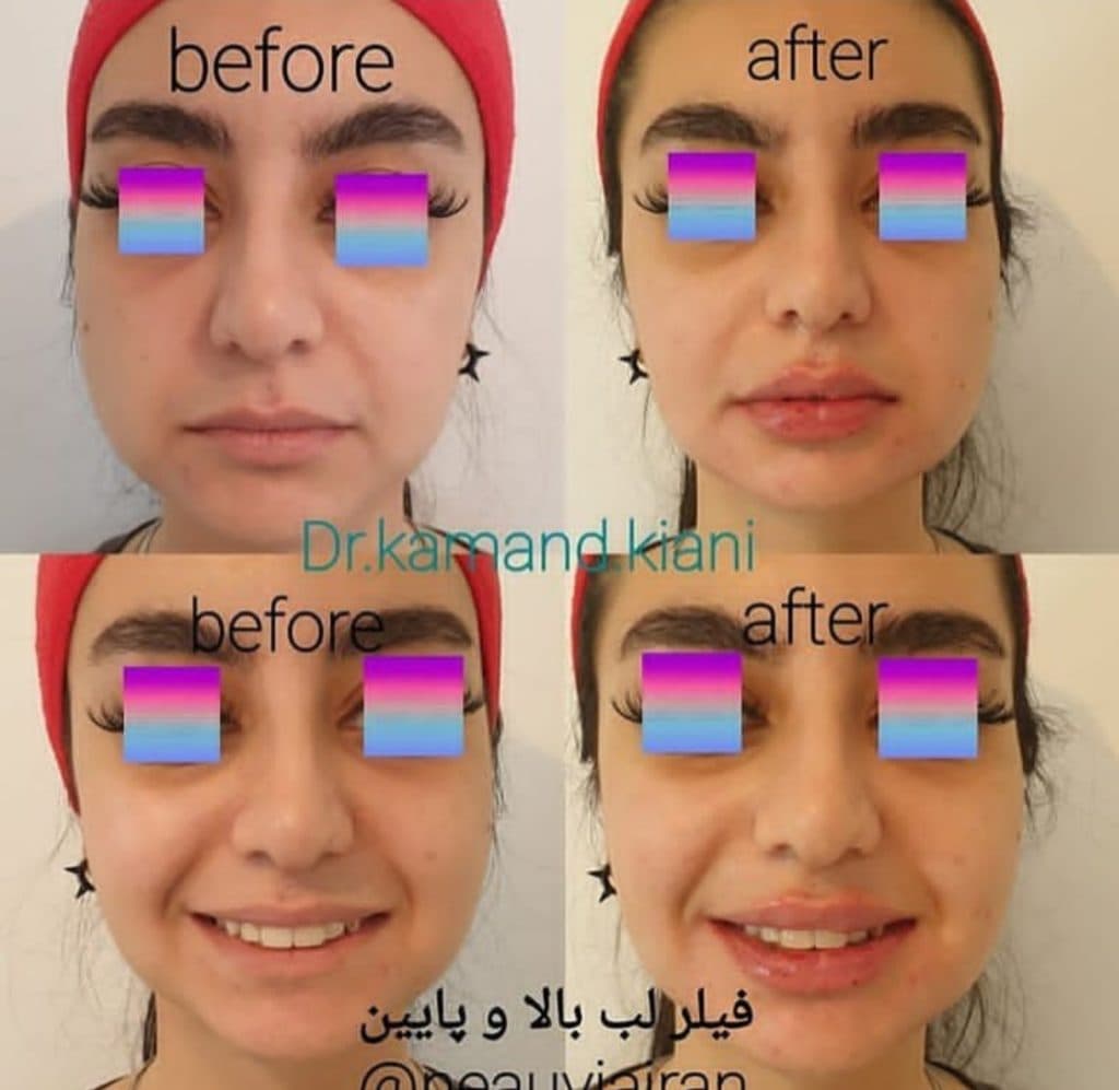 مرکز تخصصی لیزر نایس خانم قاعدی در رفسنجان