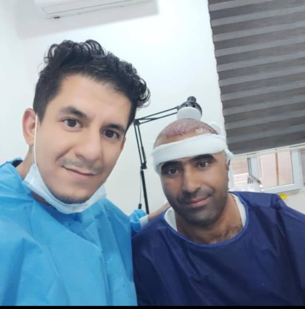 کاشت مو غلامی تبریز