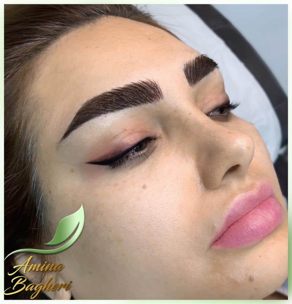 مرکز تخصصی میکروبلیدینگ و فیبروز آمینا باقری در شیراز