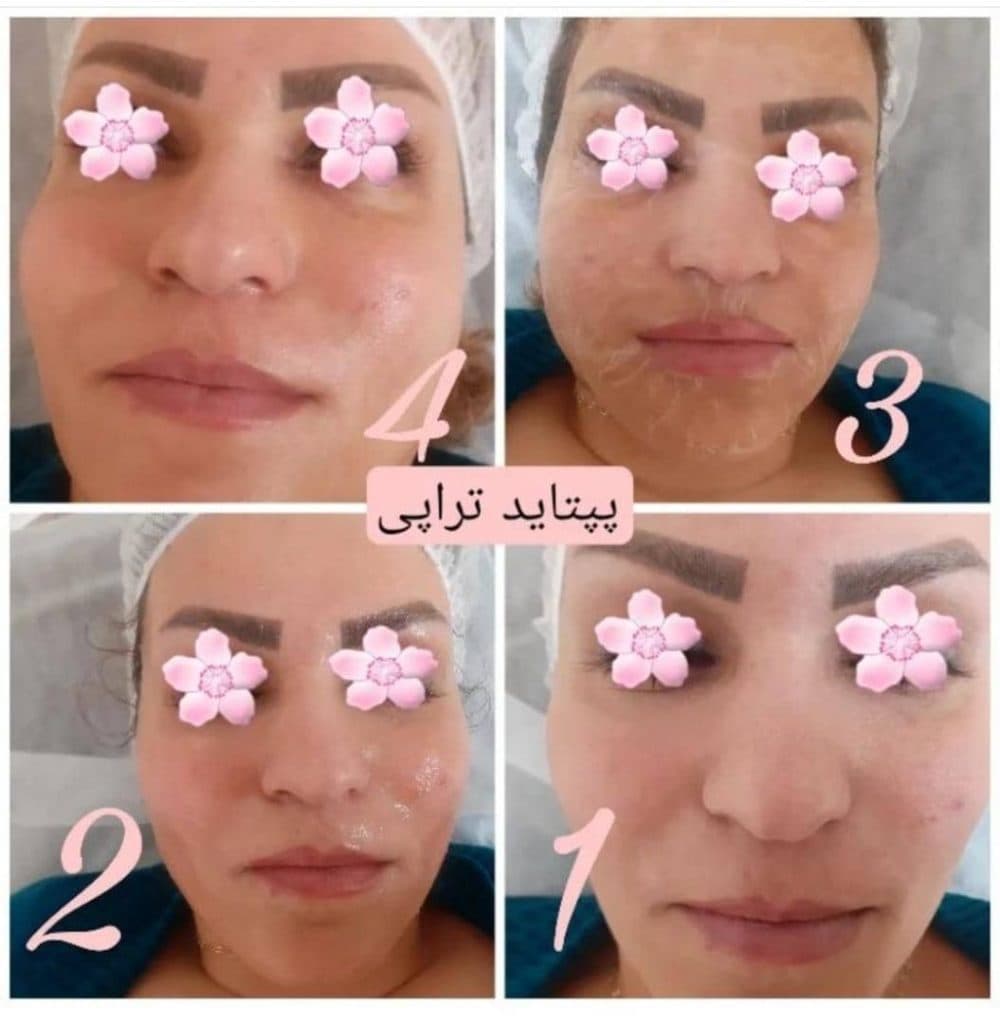 مرکز زیبایی مریلا بیوتی در اصفهان