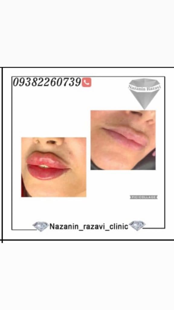 کلینیک زیبایی پوست و مو نازنین رضوی در تهران