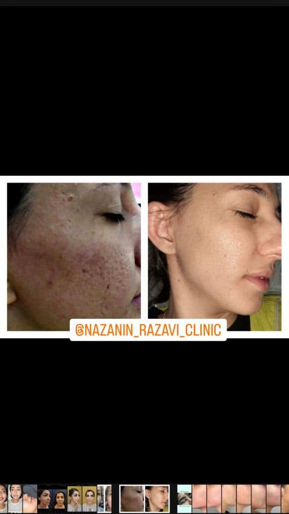 کلینیک زیبایی پوست و مو نازنین رضوی در تهران