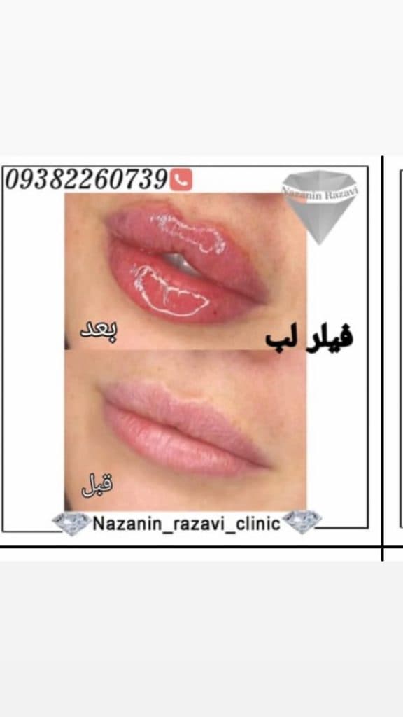 کلینیک زیبایی پوست و مو نازنین رضوی در تهران