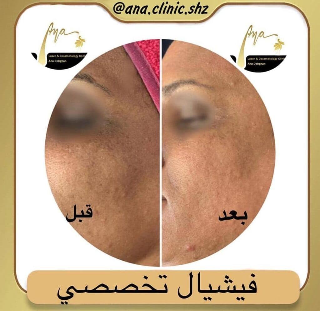 کلینیک زیبایی آنا در شیراز