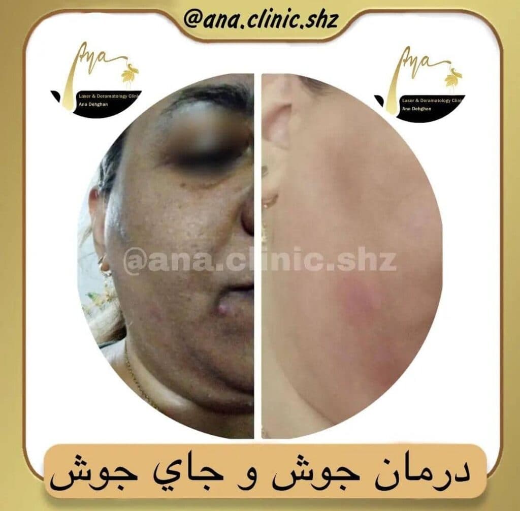 کلینیک زیبایی آنا در شیراز