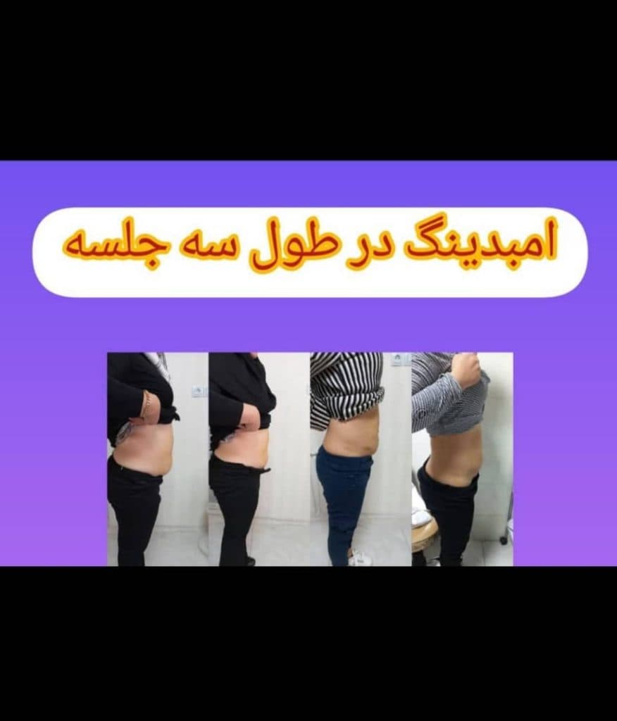 کلینیک زیبایی لیزر و لاغری لیلیوم در سنندج