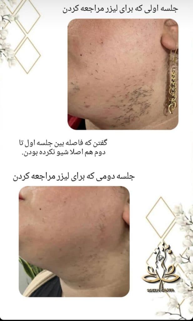 کلینیک زیبایی و لیزر رزا در بندر ماهشهر