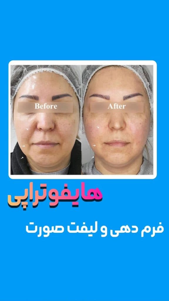 مرکز بوتاکس و تزریق ژل دکتر شهبازی در یزد