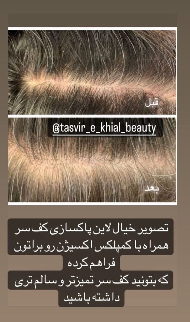 سالن زیبایی تصویر خیال در نیشابور