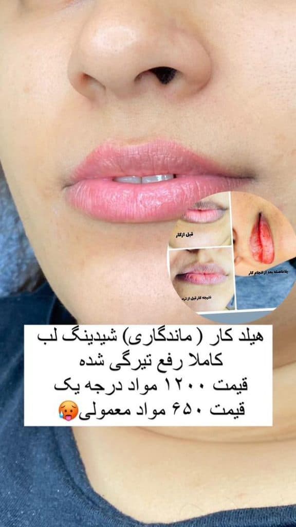 آموزش و خدمات شیدینگ و فیبروز ابرو هانیه پگاه در بندرعباس