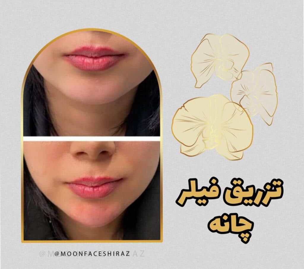 مرکز زیبایی پوست و لیزر و فیشال مون فیس در شیراز