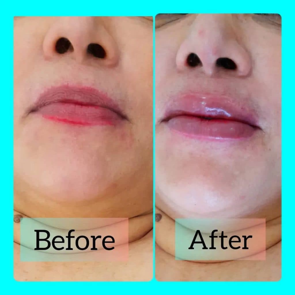 کلینیک پوست مو زیبایی و لیزر دکتر محمد باقری در کیش