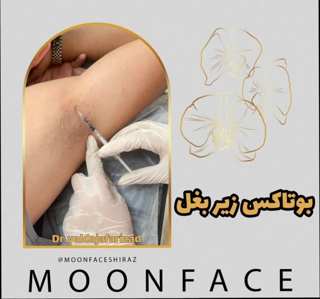 مرکز زیبایی پوست و لیزر و فیشال مون فیس در شیراز