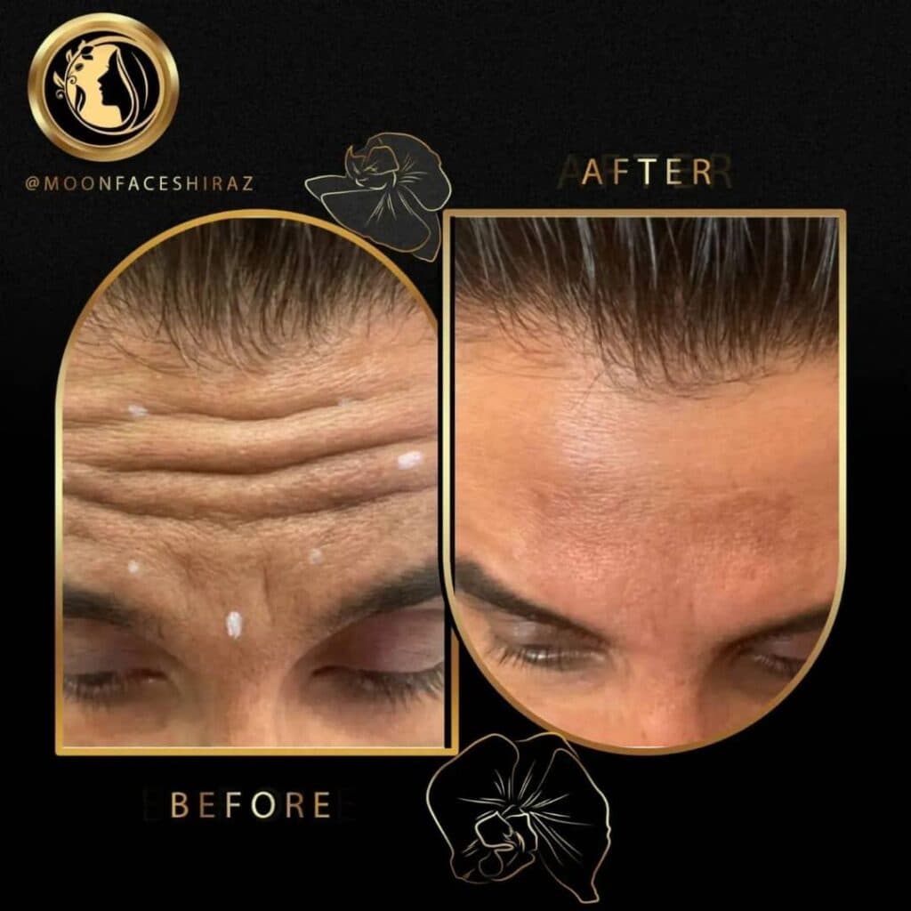 مرکز زیبایی پوست و لیزر و فیشال مون فیس در شیراز
