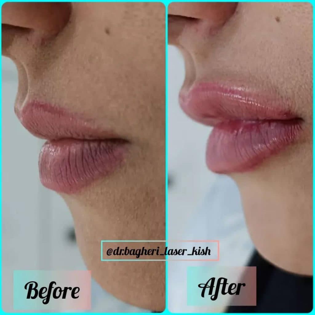 کلینیک پوست مو زیبایی و لیزر دکتر محمد باقری در کیش