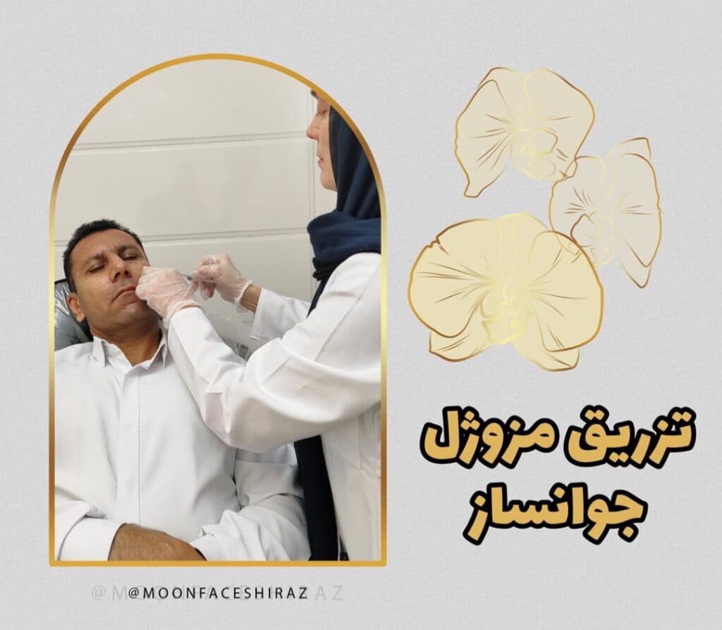 مرکز زیبایی پوست و لیزر و فیشال مون فیس در شیراز
