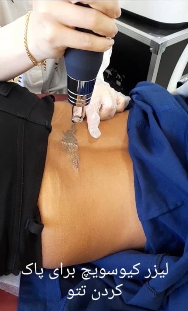 کلینیک پوست مو زیبایی و لیزر دکتر محمد باقری در کیش