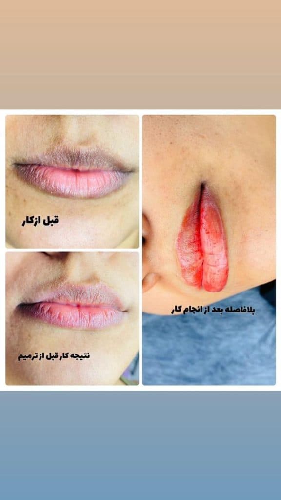 آموزش و خدمات شیدینگ و فیبروز ابرو هانیه پگاه در بندرعباس