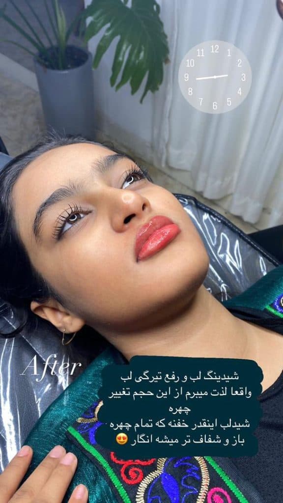 آموزش و خدمات شیدینگ و فیبروز ابرو هانیه پگاه در بندرعباس