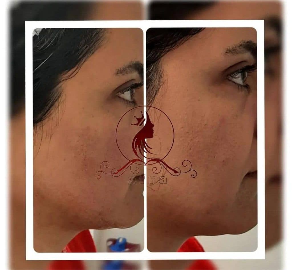 کلینیک پوست مو و زیبایی افرا در شهریار