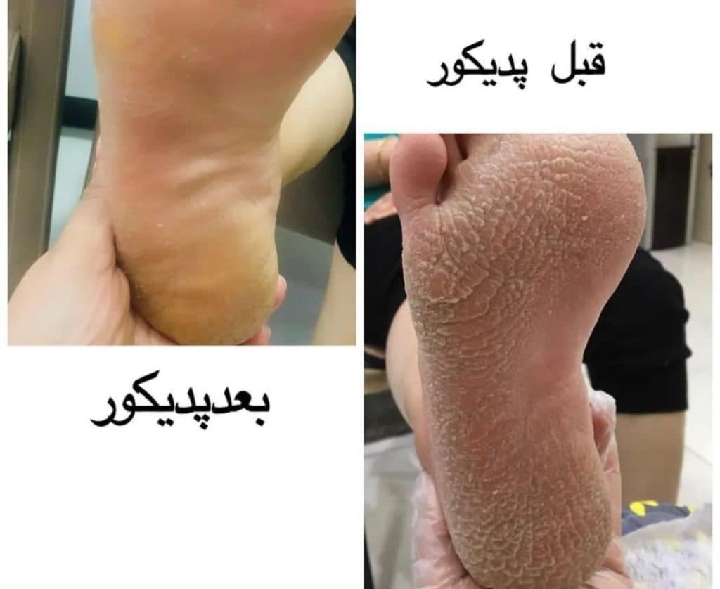 مرکز زیبایی پاکسازی پوست و فشیال آدا در زاهدان