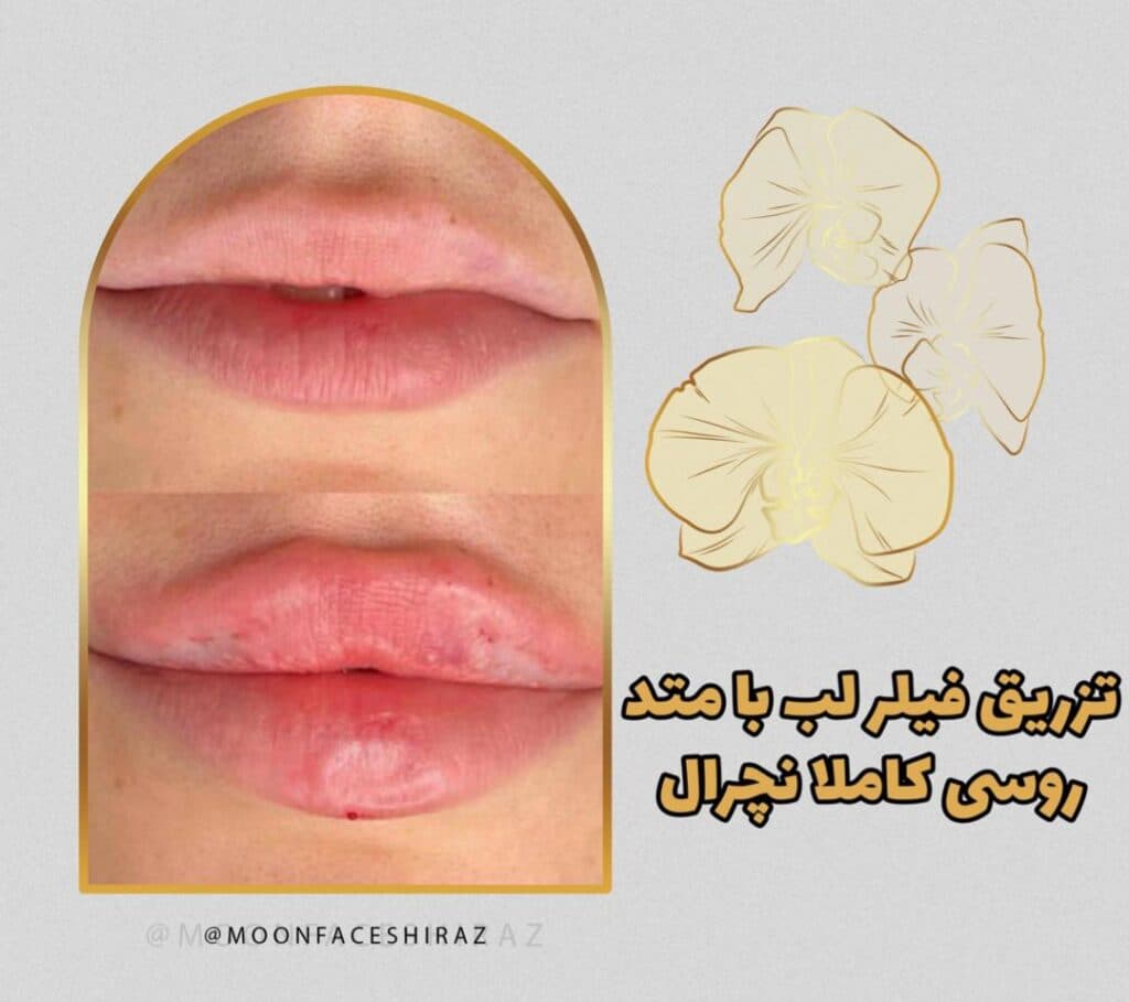 مرکز زیبایی پوست و لیزر و فیشال مون فیس در شیراز