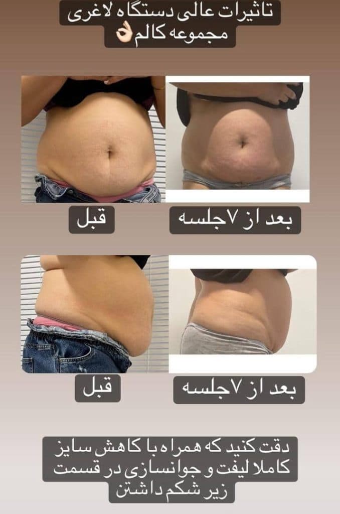 کلینیک زیبایی کالم در آمل مازندران