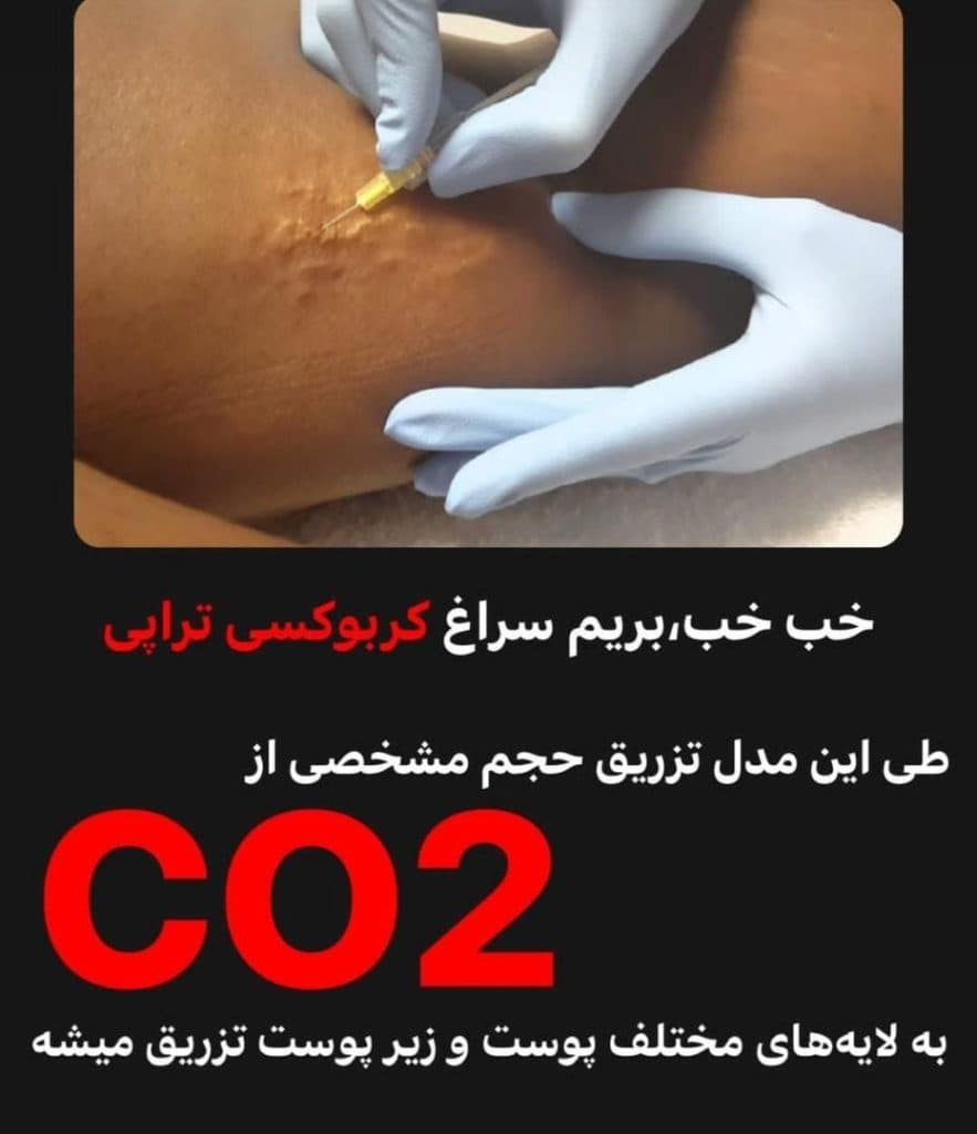 مرکز پوست مو و لیزر و زیبایی ریرا در تبریز