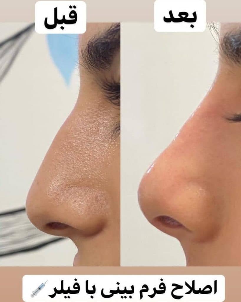 کلینیک زیبایی کالم در آمل مازندران