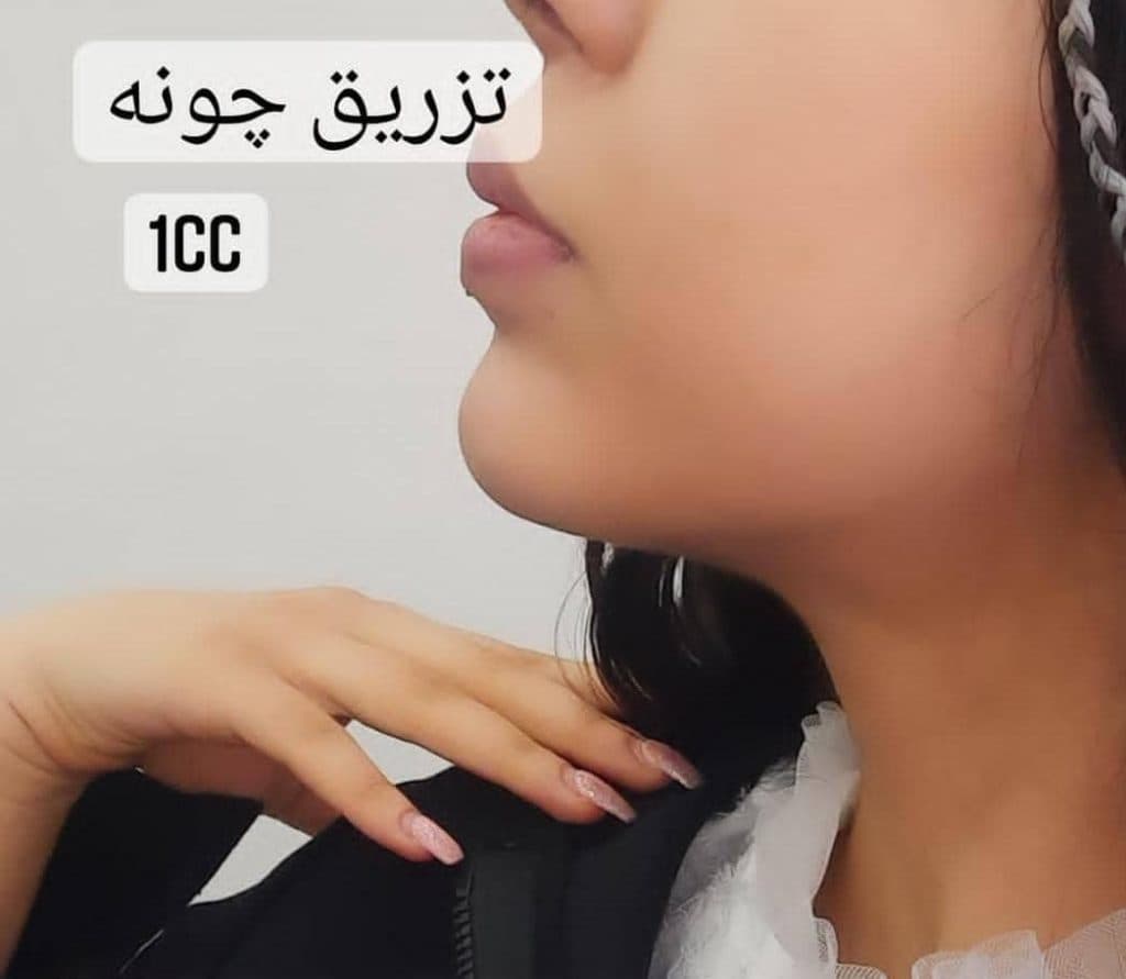 کلینیک زیبایی تخصصی پوست و مو لنا در تهران