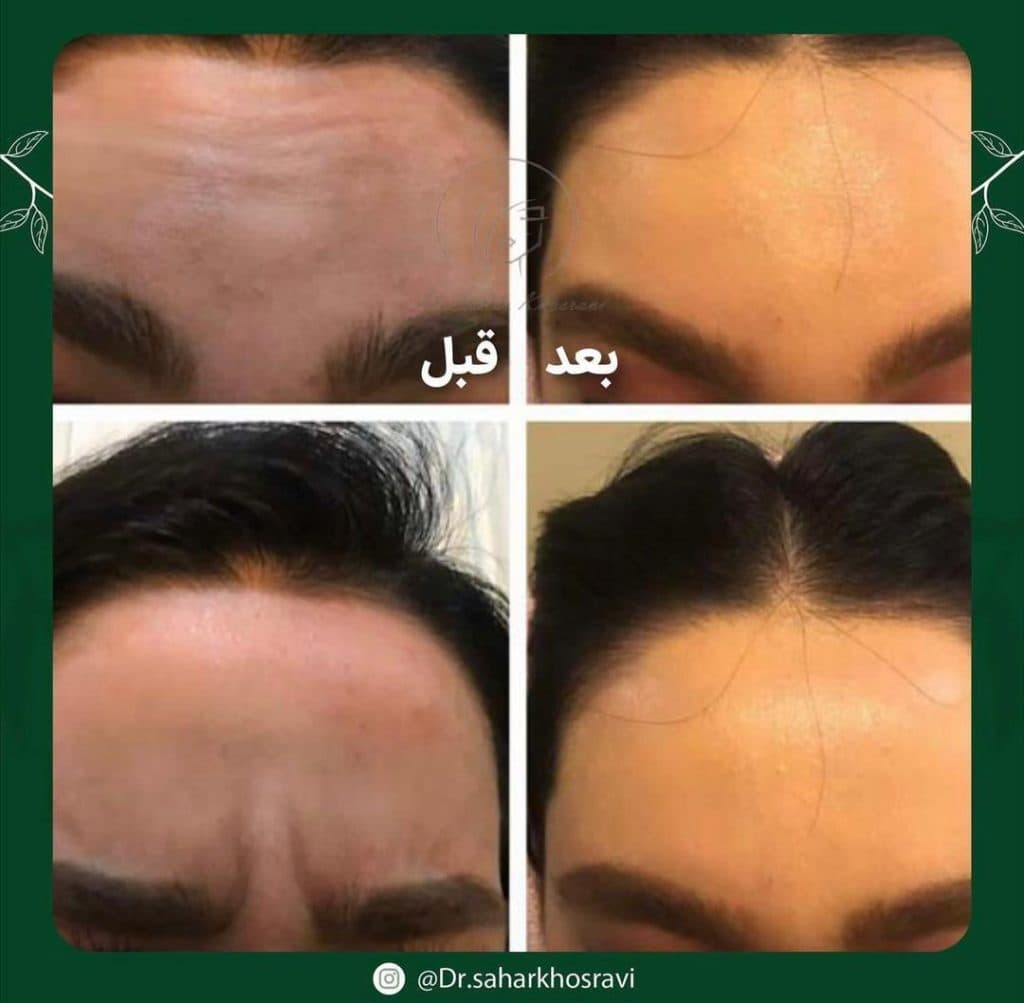 کلینیک زیبایی پوست و مو و بوتاکس و کانتورینگ دکتر سحر خسروی در تهران