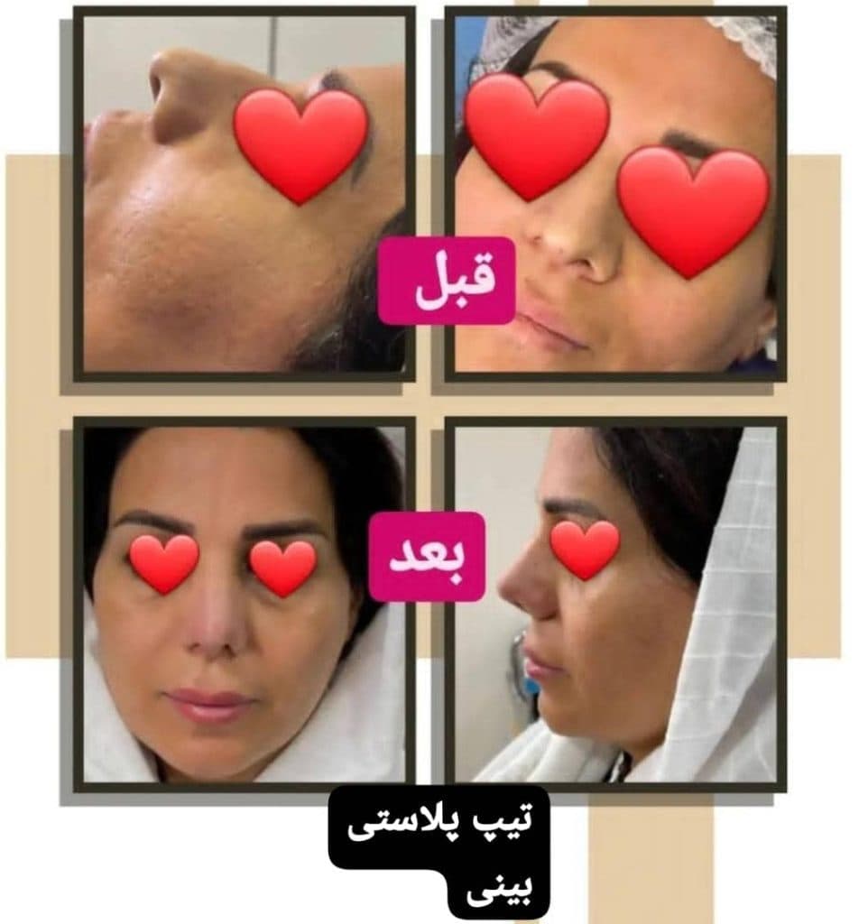 کلینیک زیبایی تخصصی پوست و مو لنا در تهران