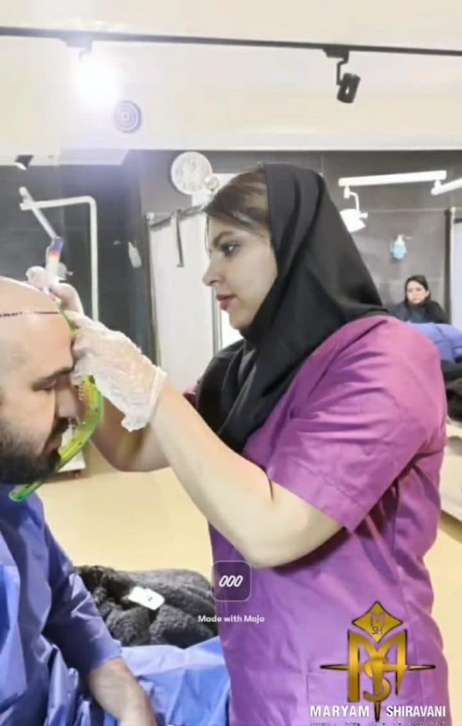 کاشت مو و ابرو مریم شیروانی در شیراز