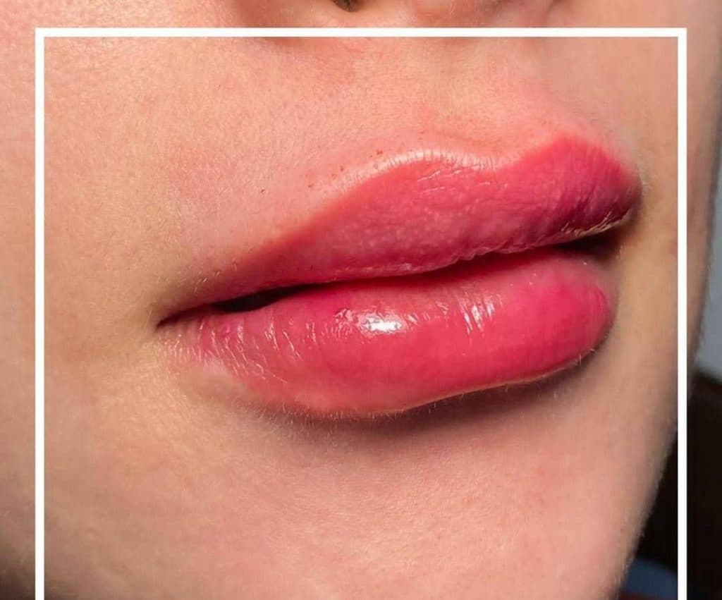 کلینیک زیبایی کالم در آمل مازندران