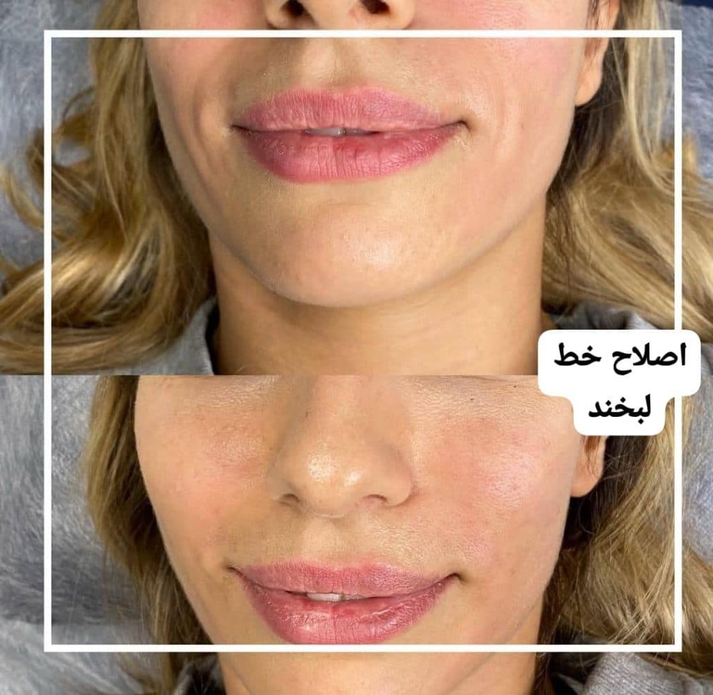 کلینیک زیبایی کالم در آمل مازندران