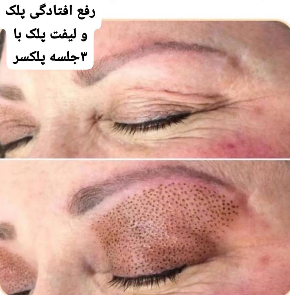 کلینیک زیبایی تخصصی پوست و مو لنا در تهران