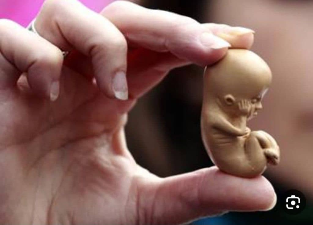 خدمات درمان زگیل تناسلی و ترمیم و لیزر و هایفو درسا در خرم آباد