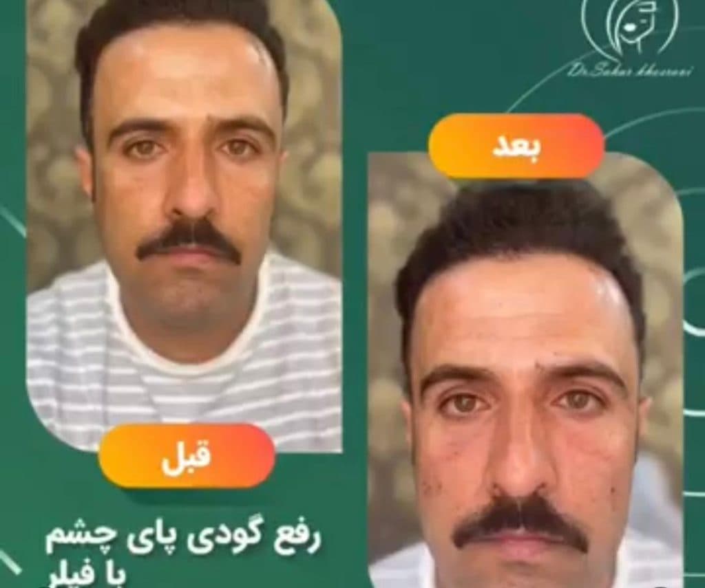 کلینیک زیبایی پوست و مو و بوتاکس و کانتورینگ دکتر سحر خسروی در تهران