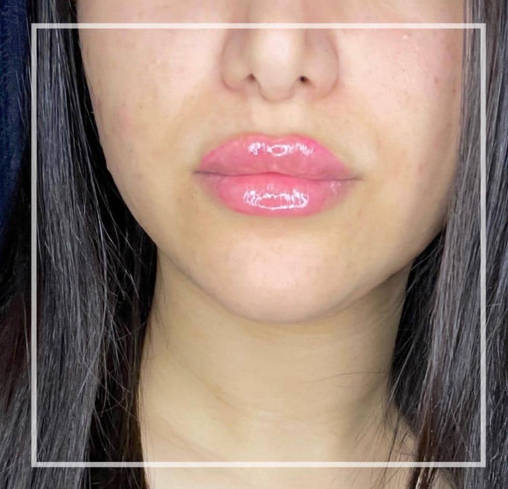 کلینیک زیبایی کالم در آمل مازندران