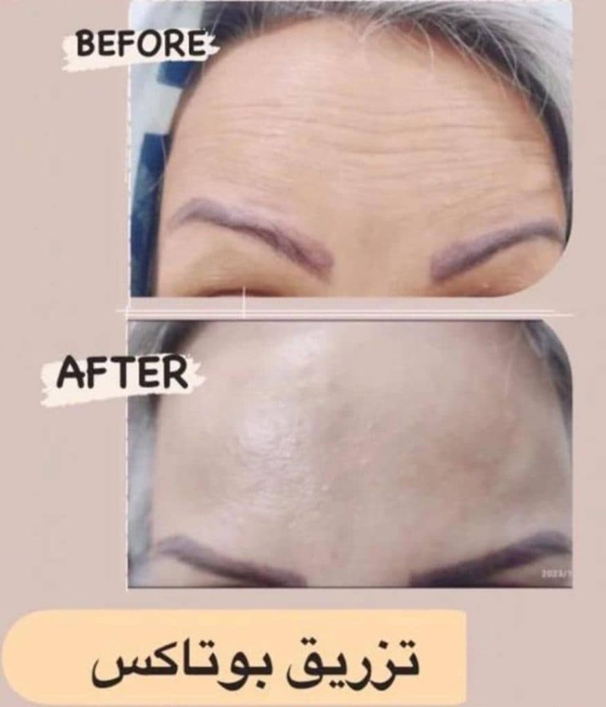 کلینیک زیبایی ژاکلین در برازجان بوشهر