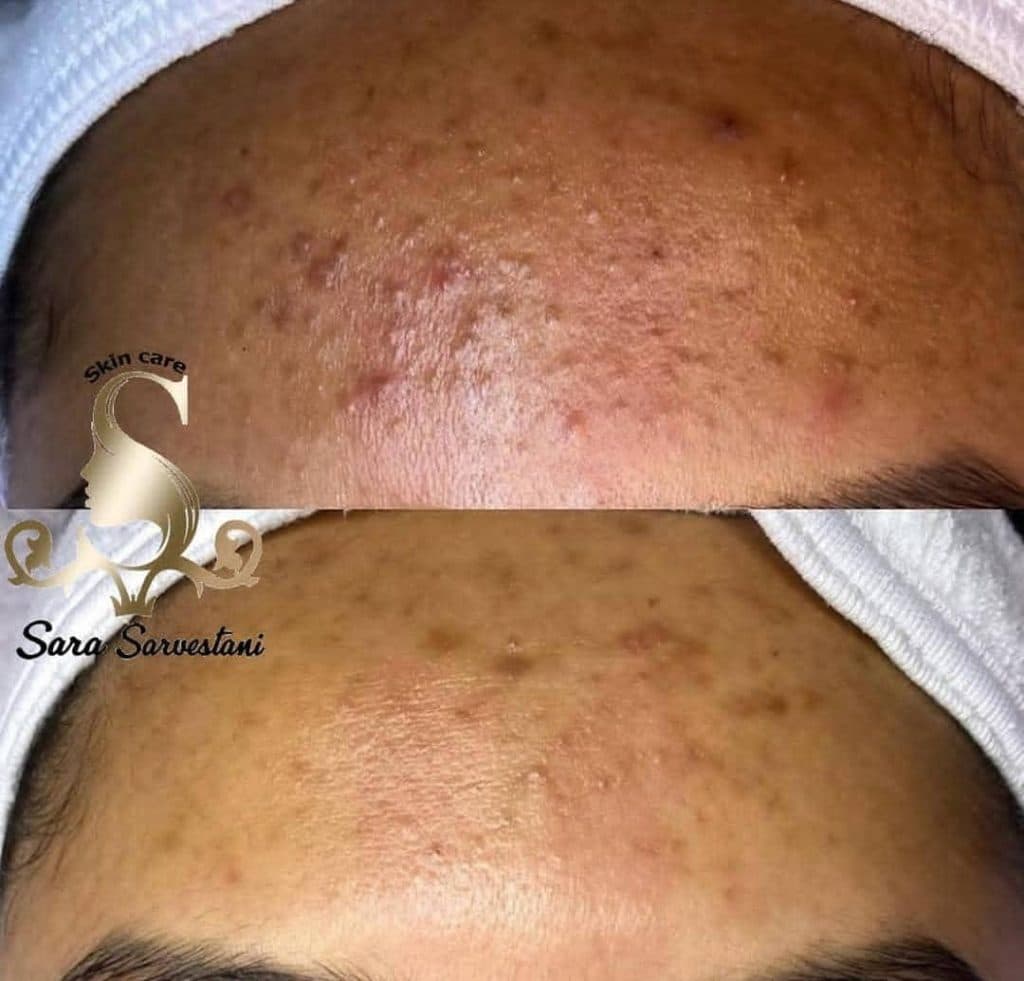 آموزشگاه فنی حرفه ای آرایشگری و مراقبت زیبایی سارا سروستانی در بندرعباس