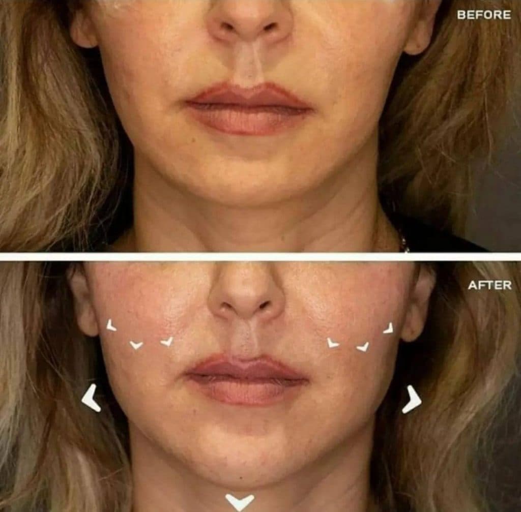 کلینیک لیزر و زیبایی رز سفید در چالوس